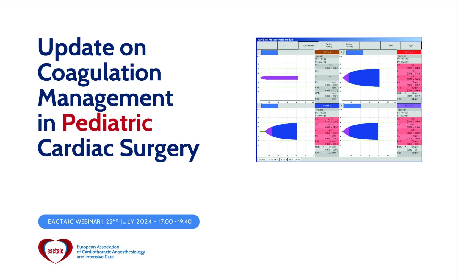 Update on Coagulation Management in Pediatric Cardiac Surgery