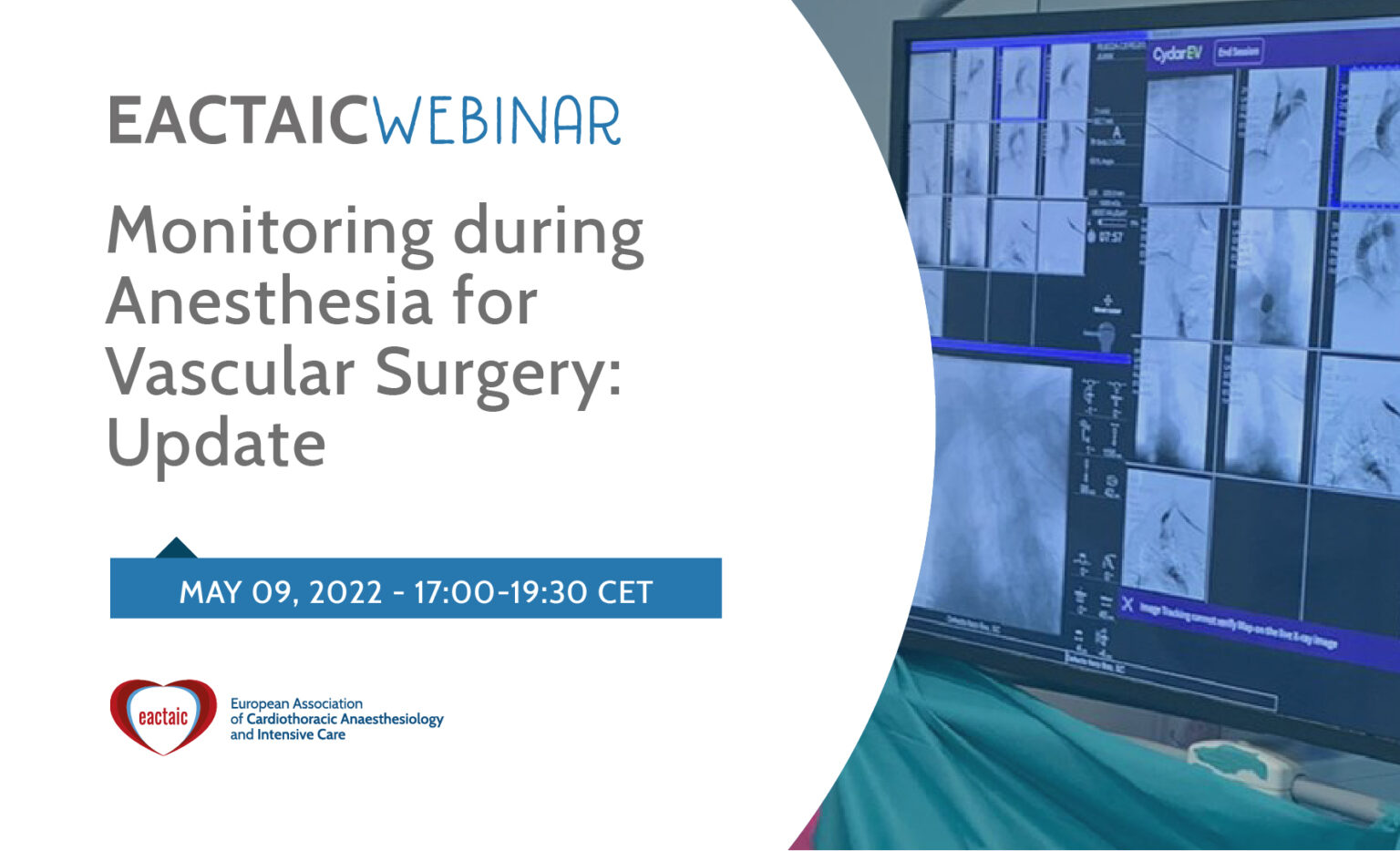Monitoring during Anesthesia for Vascular Surgery: Update