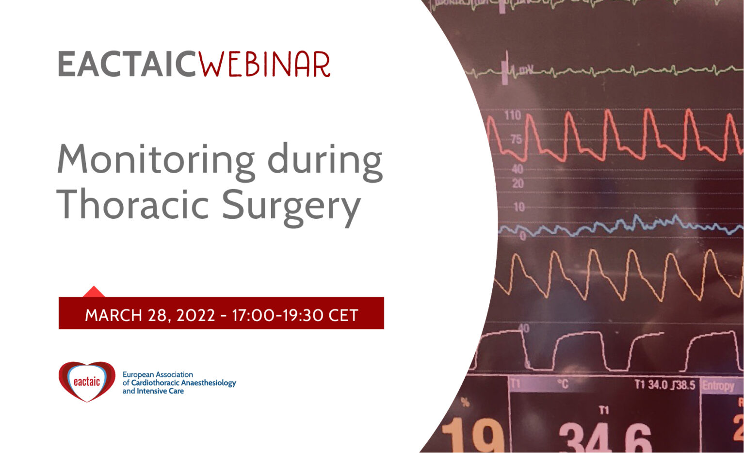 Monitoring during Thoracic Surgery
